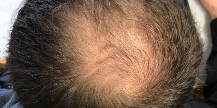 ಈ ಲಕ್ಷಣಗಳಿದ್ದರೆ ನೀವು ಬಾಂಡ್ಲಿಯಾಗುತ್ತಿದ್ದೀರಿ ಎಂದರ್ಥ..