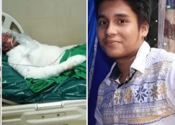 ದೊಡ್ಡಪ್ಪನ ಮಗಳನ್ನು ಪ್ರೀತಿಸಿದ್ದ ಯುವಕ ಸುಟ್ಟಗಾಯಗಳಿಂದ ಸಾವು