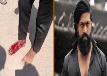 ಮತ್ತೊಬ್ಬ ಯಶ್‌ ಅಭಿಮಾನಿಯ ಅನಾಹುತ : ಕಾಲಿನ ಮೇಲೆ ಹರಿದ ಯಶ್‌ ಬೆಂಗಾವಲು ಕಾರು..!