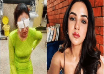 ಕಾಂಟ್ಯಾಕ್ಟ್‌ ಲೆನ್ಸ್‌ ಎಡವಟ್ಟು : ಕಣ್ಣನ್ನೇ ಕಳೆದುಕೊಳ್ಳೋ ಭಯದಲ್ಲಿ ಕೋಮಲ್‌ ಹೀರೋಯಿನ್‌ ಜಾಸ್ಮಿನ್. ಈ ತಪ್ಪು ಮಾಡಬೇಡಿ..!