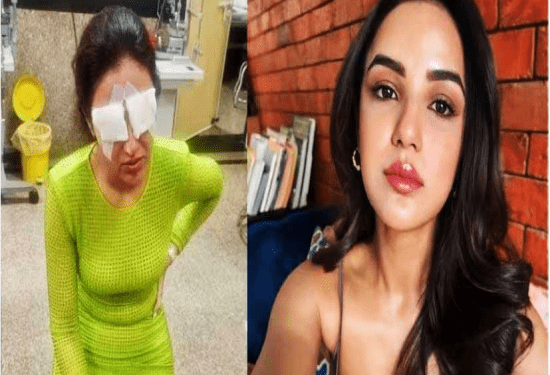 ಕಾಂಟ್ಯಾಕ್ಟ್‌ ಲೆನ್ಸ್‌ ಎಡವಟ್ಟು : ಕಣ್ಣನ್ನೇ ಕಳೆದುಕೊಳ್ಳೋ ಭಯದಲ್ಲಿ ಕೋಮಲ್‌ ಹೀರೋಯಿನ್‌ ಜಾಸ್ಮಿನ್. ಈ ತಪ್ಪು ಮಾಡಬೇಡಿ..!