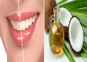 ಹಲ್ಲು ಬೆಳ್ಳಗೆ ಹೊಳೆಯೋಕೆ ಕೊಬ್ಬರಿ ಎಣ್ಣೆ ಸಾಕು : ಹಳದಿ ಹೋಗೋಕೆ ಸಿಂಪಲ್‌ ಟಿಪ್ಸ್‌