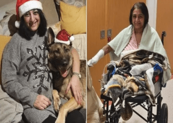 ನಾಯಿ ನೆಕ್ಕಿ ಸೋಂಕು : ಮಹಿಳೆಯ ಕೈ, ಕಾಲು ಎರಡನ್ನೂ ಕತ್ತರಿಸಿದ ವೈದ್ಯರು